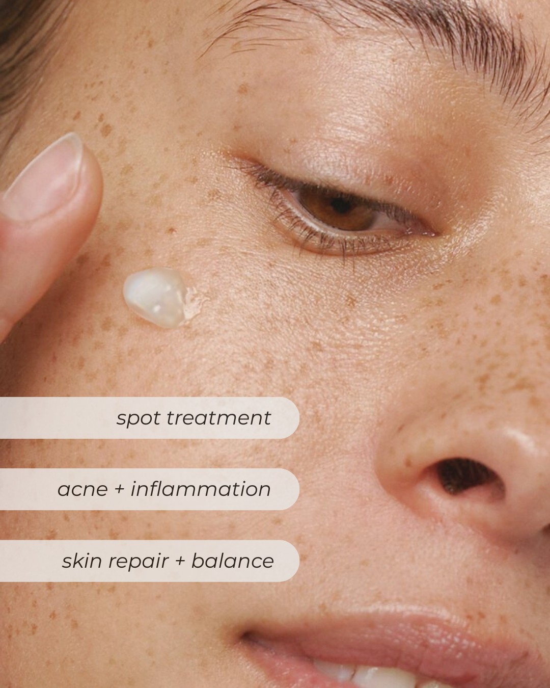 Blemish Cream - 50ml