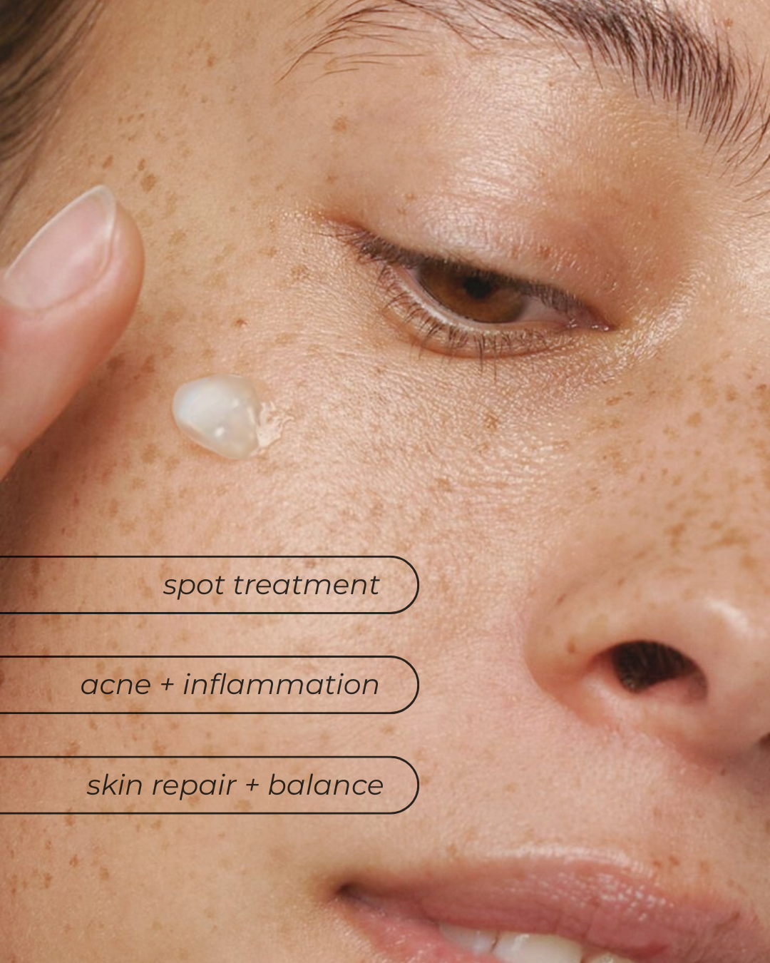 Blemish Cream - 50ml (discounted due to lid)